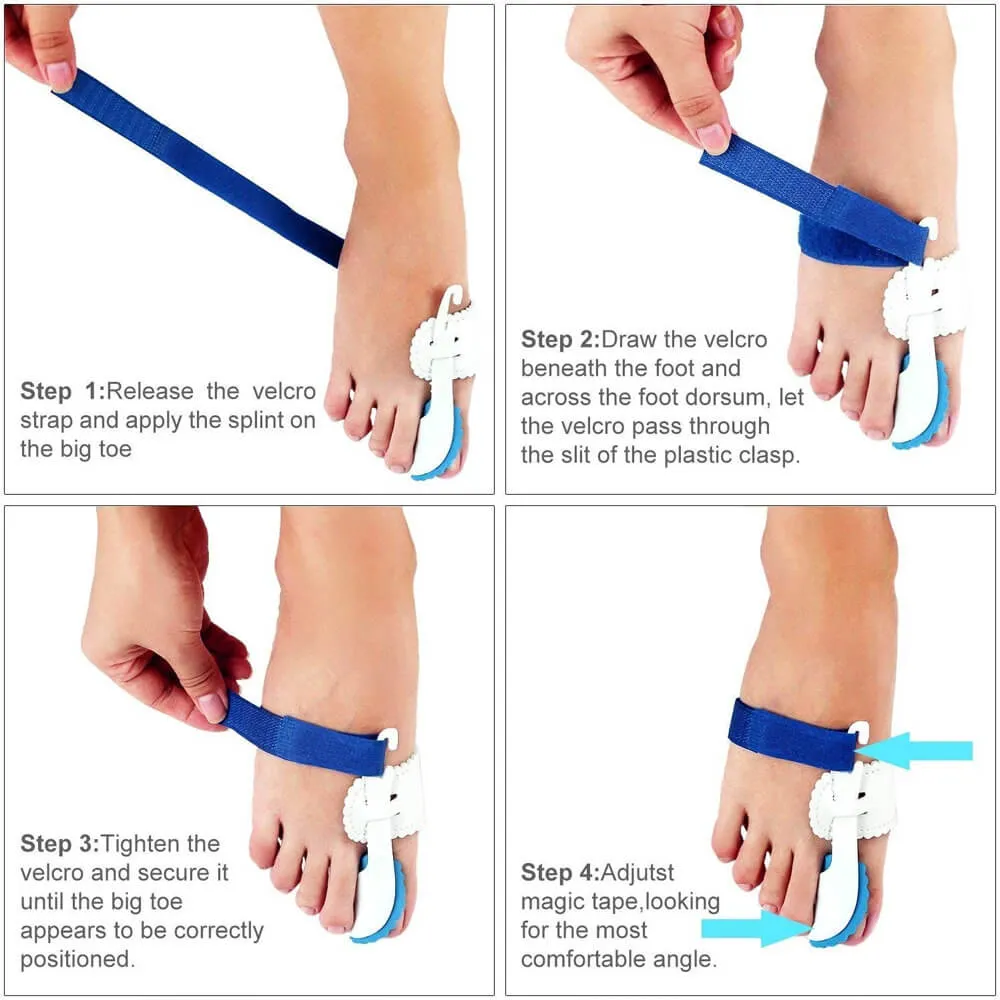Bunion Corrector for Men & Women